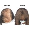 Hair Loss Mesh Integration - Image 2